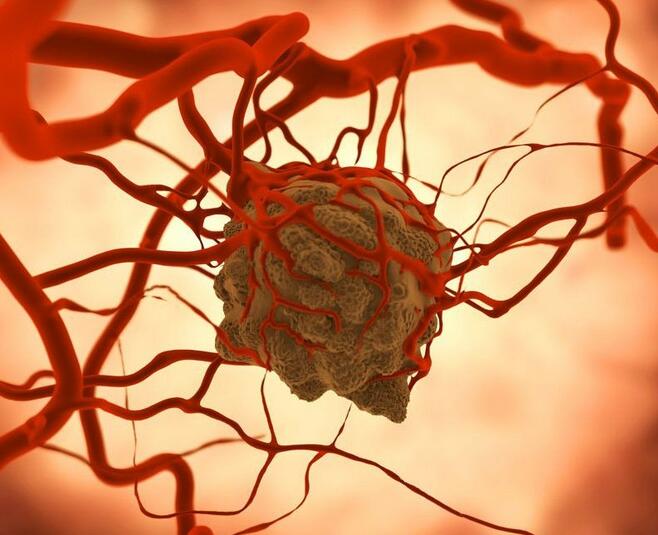 罗恩克拉克_克罗恩吧_罗恩克拉克