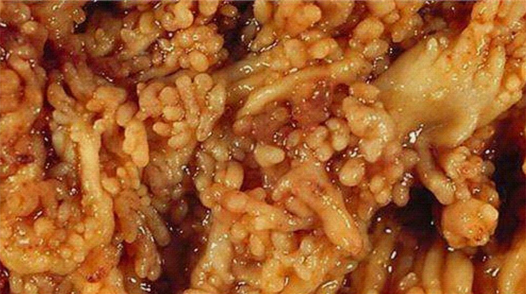 罗恩克拉克_罗恩克拉克_克罗恩吧