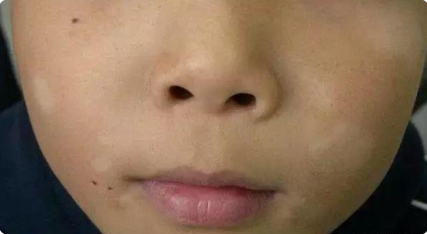 发病哮喘症状小儿怎么治疗_小儿哮喘发病症状_小儿哮喘发作特点