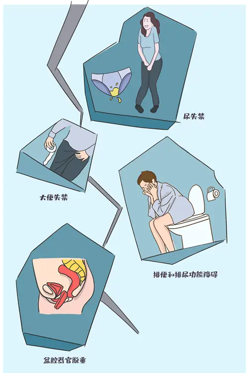 肛门失禁：让人尴尬又无奈的健康问题，该如何解决？