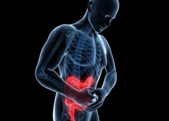 罗克罗恩病的特征性体征_罗克罗恩病_克罗恩病的六大标准