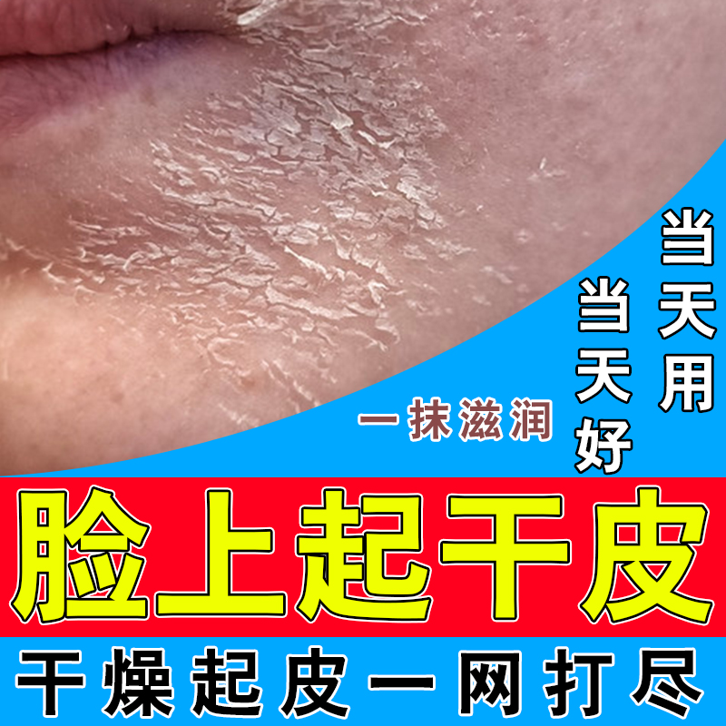 春天脸脱皮怎么办？原因竟然是这样