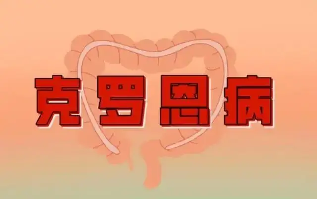 克罗恩病：慢性肠道疾病的痛苦与无奈，患者该如何应对？